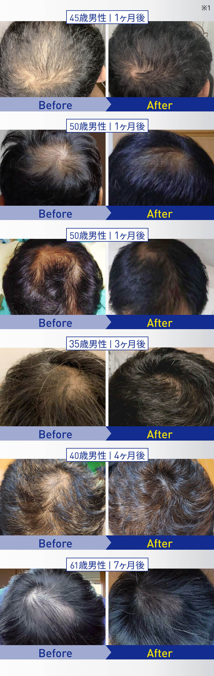 ビフォーアフター