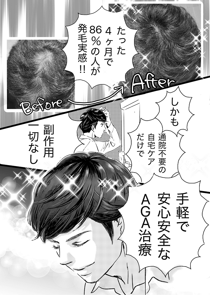 手軽で安心安全なAGA治療