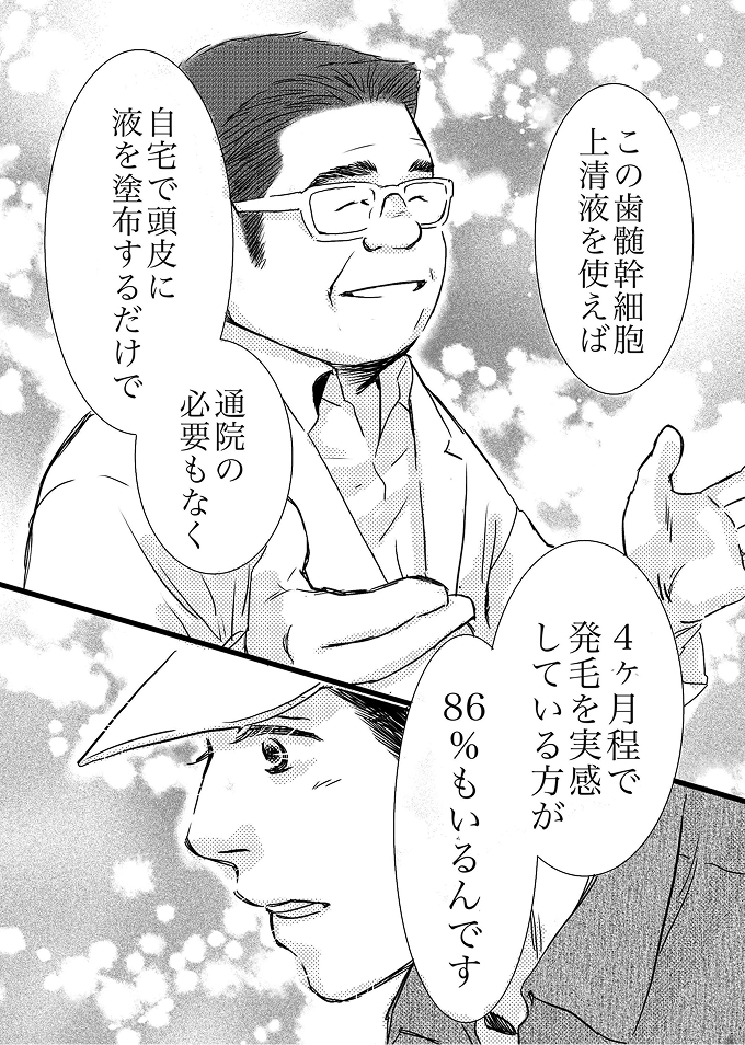 4ヶ月の発毛実感86%