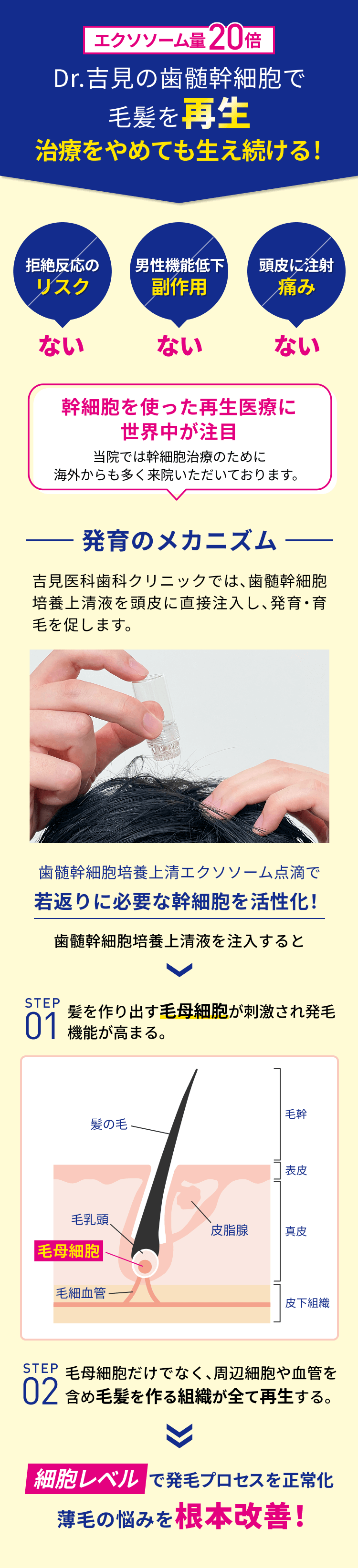 エクソソーム量20倍 Dr.吉見の歯髄幹細胞で毛髪を再生！治療をやめても生え続ける発毛のメカニズム